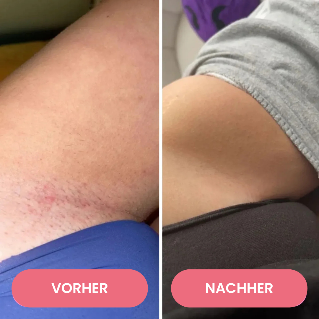 SmoothTrim™ - 2in1 schmerzfreier Dual-Trimmer