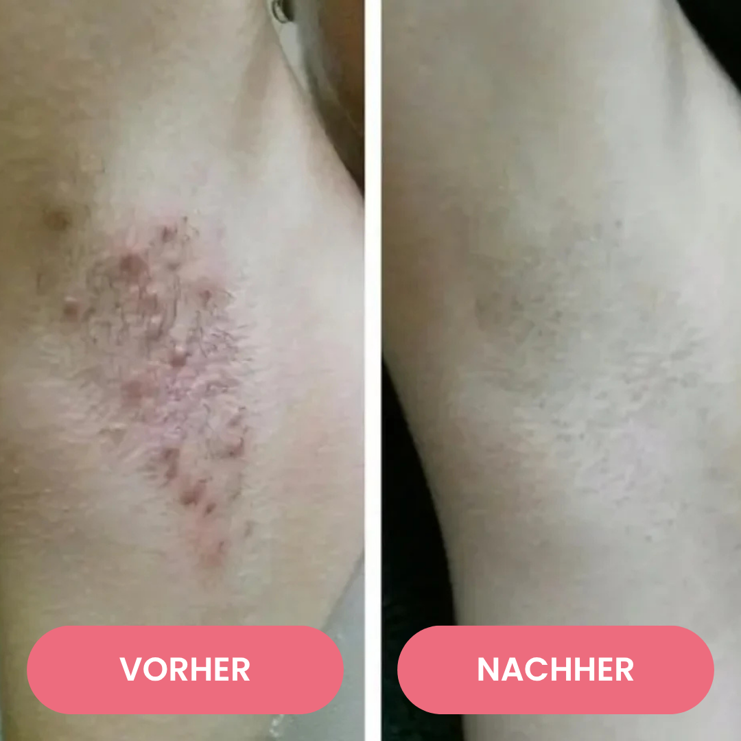 SmoothTrim™ - 2in1 schmerzfreier Dual-Trimmer