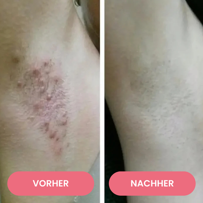 SmoothTrim™ - 2in1 schmerzfreier Dual-Trimmer