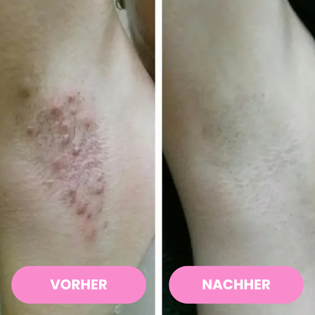 SmoothTrim - 2in1 schmerzfreier Dual-Trimmer